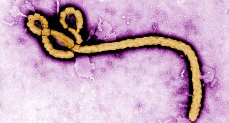 PR/Pressemitteilung: Ebola-Impfstoff kommt frühestens Anfang 2015